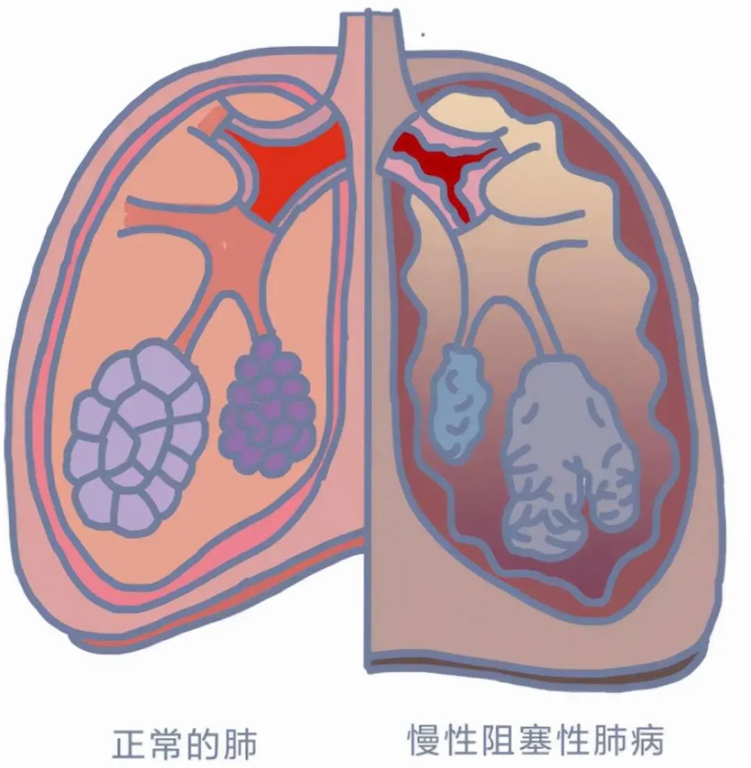 【关注】身患16种病！其中一种比癌症还致命……